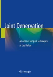 book Joint Denervation: An Atlas of Surgical Techniques