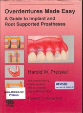 book Overdentures made easy a guide to implant and root supported prostheses