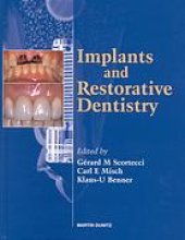 book Implants and restorative dentistry