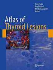 book Atlas of thyroid lesions