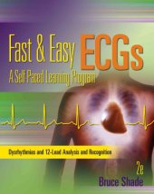 book Fast & easy ECGs : a self-paced learning program