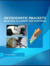 book Orthodontic Bracket Selection Preview