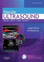 book Vascular Ultrasound E-Book (How, Why and When)