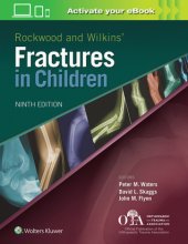 book Rockwood and Wilkins Fractures in Children