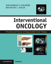 book Interventional Oncology: Principles and Practice of Image-Guided Cancer Therapy