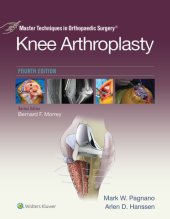 book Master Techniques in Orthopedic Surgery: Knee Arthroplasty