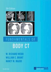 book Fundamentals of Body CT