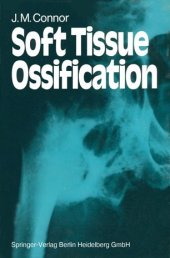 book Soft Tissue Ossification