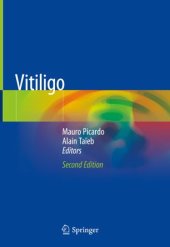 book Vitiligo