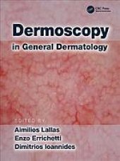 book Dermoscopy in general dermatology