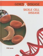 book Sickle Cell Disease (Genes and Disease)