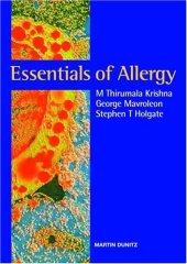 book Essentials of Allergy