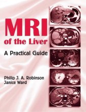 book MRI of the Liver: A Practical Guide