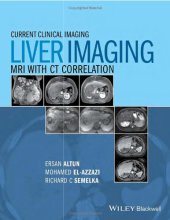 book Liver imagaing MRI with CT correlation.