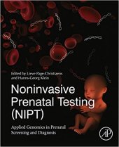 book Noninvasive Prenatal Testing (Nipt): Applied Genomics in Prenatal Screening and Diagnosis