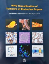 book WHO  Classification of Tumours of Endocrine Organs