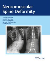 book Neuromuscular spine deformity