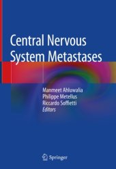 book Central Nervous System Metastases