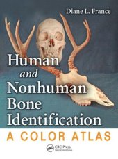 book Human and Non-Human Bone Identification. A color atlas