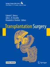 book Transplantation Surgery