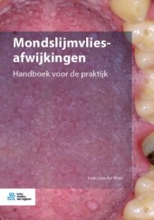 book Mondslijmvliesafwijkingen: Handboek voor de praktijk