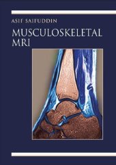 book Musculoskeletal MRI