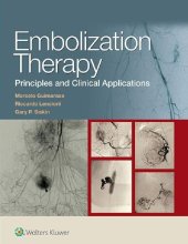 book Embolization Therapy: Principles and Clinical Applications