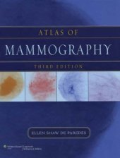 book Atlas of mammography