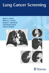 book Lung cancer screening