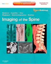 book Imaging of the Spine