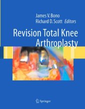 book Revision Total Knee Arthroplasty