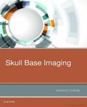 book Skull Base Imaging