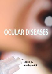 book Ocular Diseases