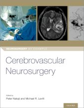 book Cerebrovascular Neurosurgery