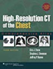 book High-Resolution CT of the Chest: Comprehensive Atlas