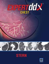 book EXPERTddx: Chest