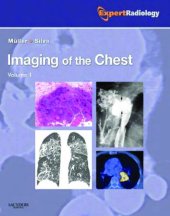 book Imaging of the Chest