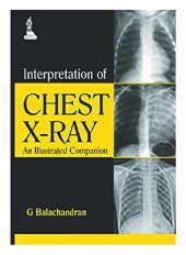 book Interpretation of Chest X-Ray: An Illustrated Companion