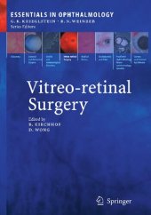 book Vitreo-retinal Surgery