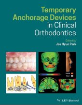 book Temporary Anchorage Devices in Clinical Orthodontics