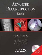 book Advanced Reconstruction: Knee