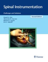 book Spinal instrumentation : challenges and solutions