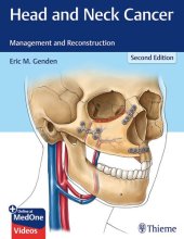 book Head and neck cancer : management and reconstruction