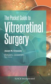 book Pocket Guide to Vitreoretinal Surgery