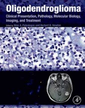 book Oligodendroglioma: Clinical Presentation, Pathology, Molecular Biology, Imaging, and Treatment