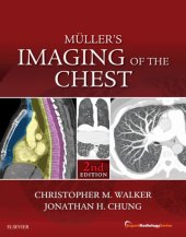 book Muller’s Imaging of the Chest