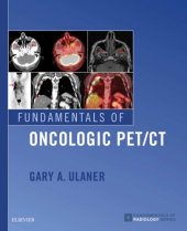 book Fundamentals of Oncologic PET/CT