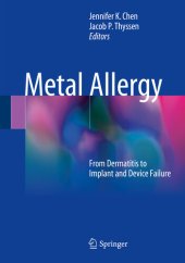 book Metal Allergy: From Dermatitis to Implant and Device Failure