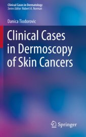 book Clinical Cases in Dermoscopy of Skin Cancers