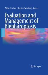 book Evaluation and Management of Blepharoptosis